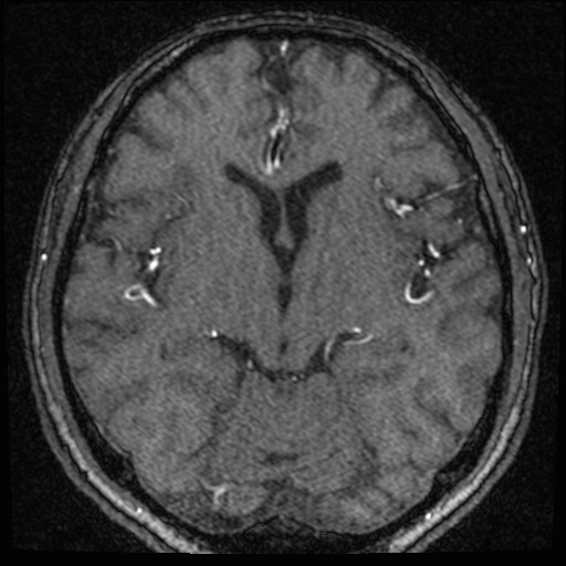 Click on the Serie image to view the images of VILLANUEVA, WILLIAM A.